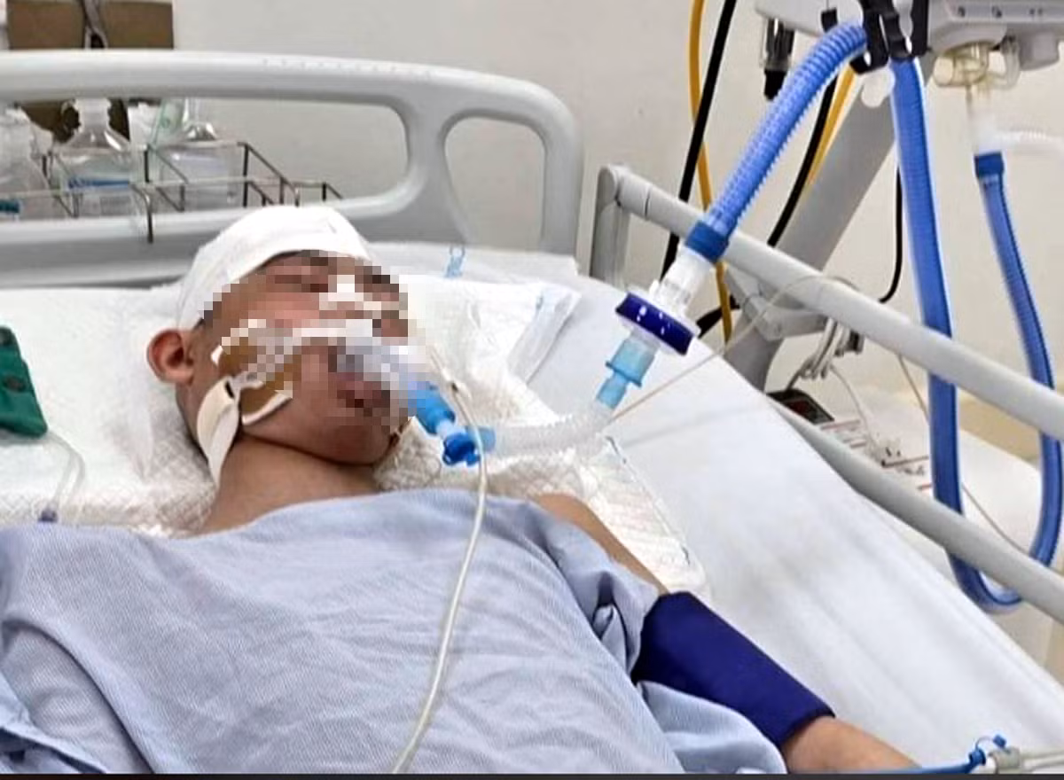 Vụ nam sinh lớp 8 bị đánh chết não: Vẫn hôn mê, thở máy Vu nam sinh lop 8 bi danh chet nao: Van hon me, tho may