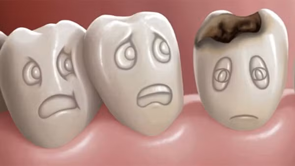 Tùy vào nhu cầu mà có thể chọn loại kem có thành phần phù hợp. Cụ thể, bạn có thể chọn kem đánh răng chứa flour để chống sâu răng; Stronti clorua, kali nitrat để chống ê buốt răng hoặc kẽm chống cao răng.