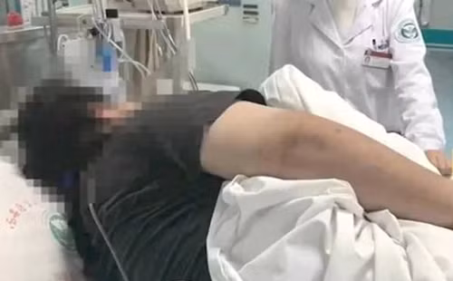 Ngày ăn 1 bữa vẫn nặng 130kg, nguyên nhân khiến bác sĩ hoảng sợ Ngay an 1 bua van nang 130kg, nguyen nhan khien bac si hoang so