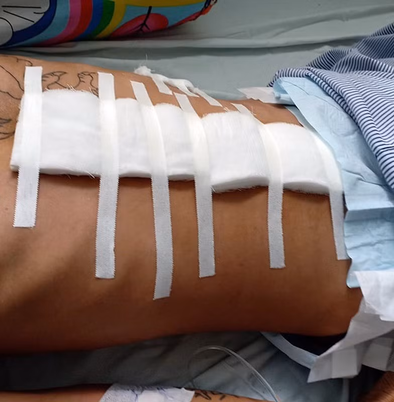 Giang hồ Hùng Sứt cùng đàn em nổ súng bắn 4 người bị thương Giang ho Hung Sut cung dan em no sung ban 4 nguoi bi thuong