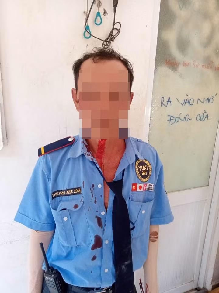 Bị nhắc không đeo khẩu trang, thanh niên lao vào đánh bảo vệ Bi nhac khong deo khau trang, thanh nien lao vao danh bao ve