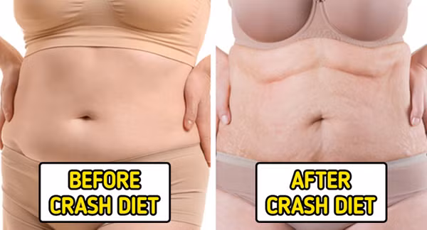 5. Áp dụng chế độ ăn kiêng cực đoan. Ăn kiêng thời gian ngắn hỗ trợ giảm cân. Vậy nhưng, ăn kiêng thời gian dài không tốt cho sức khỏe. (Ảnh: Brightside)