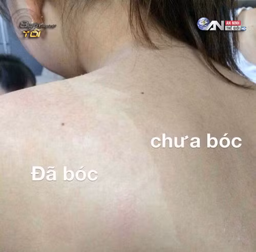 Mê trận lột da tắm trắng siêu tốc giá bèo hút teen Việt Me tran lot da tam trang sieu toc gia beo hut teen Viet