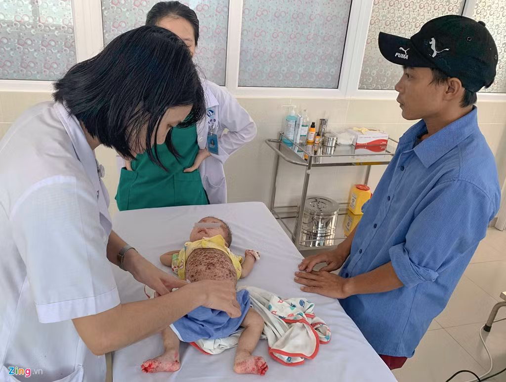 Con mắc bệnh hiếm, cha mẹ tưởng bị tay chân miệng Con mac benh hiem, cha me tuong bi tay chan mieng