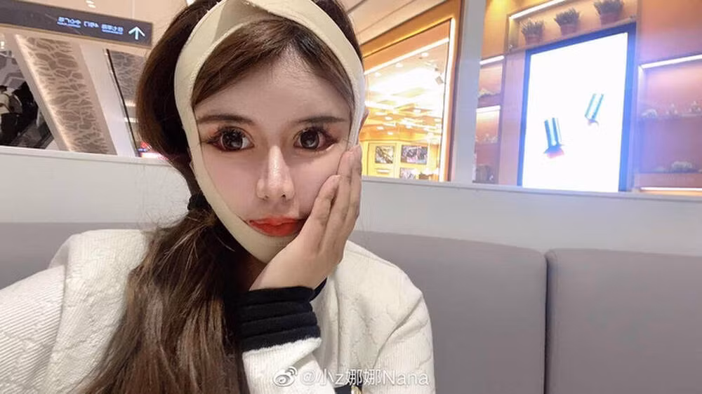Tiểu Z Na Na hiện đang là một hiện tượng nổi bật trên MXH Trung Quốc với màn phẫu thuật thẩm mỹ gương mặt hơn 100 lần từ năm 13 tuổi.