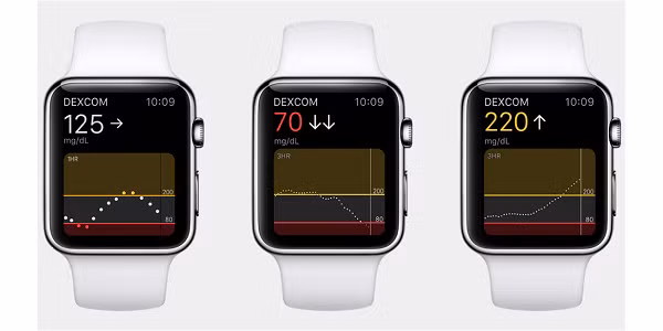 Bên cạnh đó, từ Apple Watch Series 4 trở lên cho phép người dùng có thể tự mình chụp điện tâm đồ, hay còn gọi là ECG - là một bài kiểm tra ghi lại tần số và cường độ của các tín hiệu điện do tim đập và co bóp.