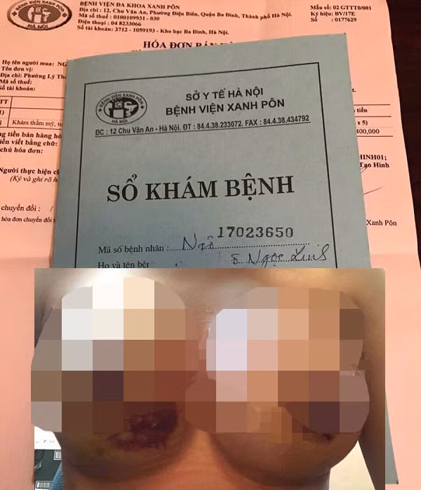Benh nhan nang nguc tai BVTM Kim Cuong A&B: Khong bien chung?-Hinh-2