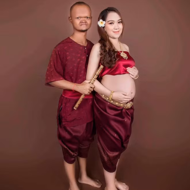 Tinh yeu cua 3 doi dua lech noi tieng voi dan mang