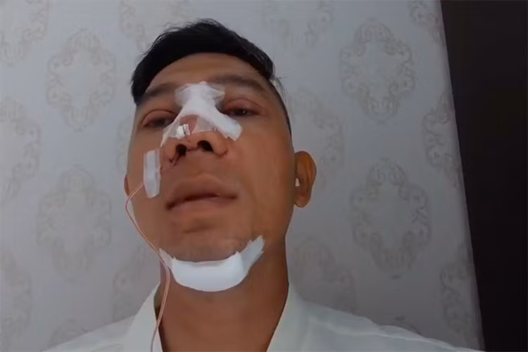 Lương Bằng Quang nâng mí, sửa mũi, độn cằm. Theo nam ca sĩ, anh dao kéo để bản thân cảm thấy hài lòng với mình hơn. Ảnh: Lao động