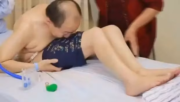 Người đàn ông sống trong tư thế gập đôi người suốt 28 năm vì căn bệnh lạ Nguoi dan ong song trong tu the gap doi nguoi suot 28 nam vi can benh la