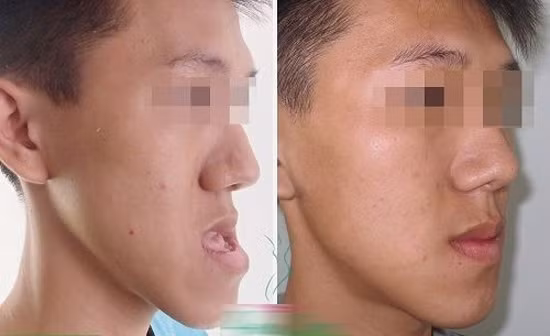 Nhung 9x Viet phau thuat tham my vit hoa thien nga hinh anh 7