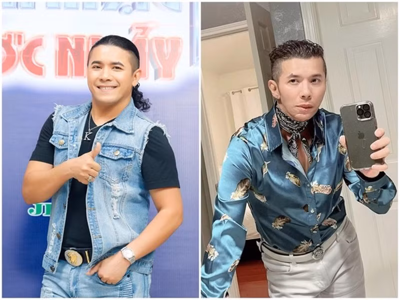 Kasim Hoàng Vũ cho biết, anh thay đổi ngoại hình vì mổ khớp xương hàm và cổ.