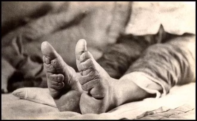 Trong lúc biểu diễn, Triệu Phi Yến để lộ đôi chân nhỏ được quấn những dải lụa. Nhà vua rất thích điệu múa và đôi chân xinh xắn của mỹ nhân này nên gọi nó là "Kim Liên Tam Thốn" (hay còn gọi gót sen ba tấc).
