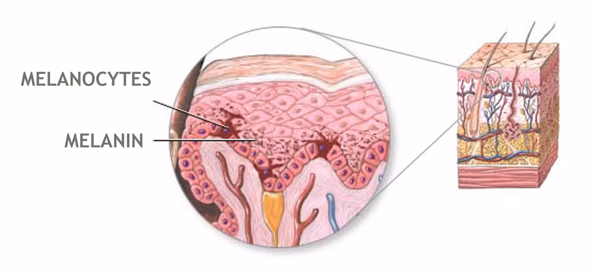 Những sắc tố Melamin được kích thích sinh sản khi bị UVA và UVB trong tia cực tím chiếu vào, hậu quả là da sẽ xuất hiện những vết ta hay gọi là thâm đen, nám hay tàn nhang, do đó sử dụng kem trắng da chống nắng là thực sự cần thiết và quan trọng nếu như bạn muốn sỡ hữu làn da trắng mịn màng.