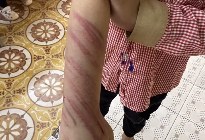 Hai Phong: Be 8 tuoi nghi bi “bo ho” danh dap da man