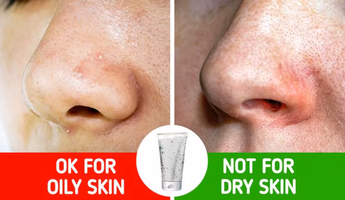 Mỹ phẩm dạng gel cho da khô. Các sản phẩm dạng gel được khuyên dùng cho da dầu, mụn. Áp dụng chúng cho làn da khô chỉ khiến bạn phí phạm, da lại càng khô hơn mà thôi.