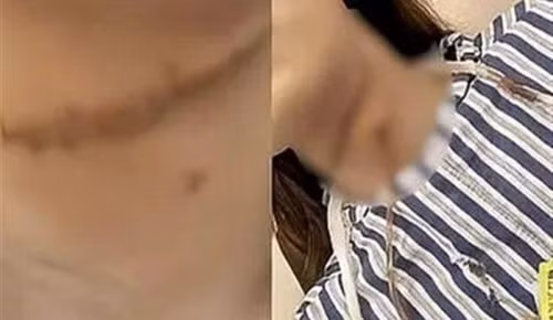 Mâu thuẫn, chồng làm điều kinh hãi với vợ và kết bất ngờ Mau thuan, chong lam dieu kinh hai voi vo va ket bat ngo