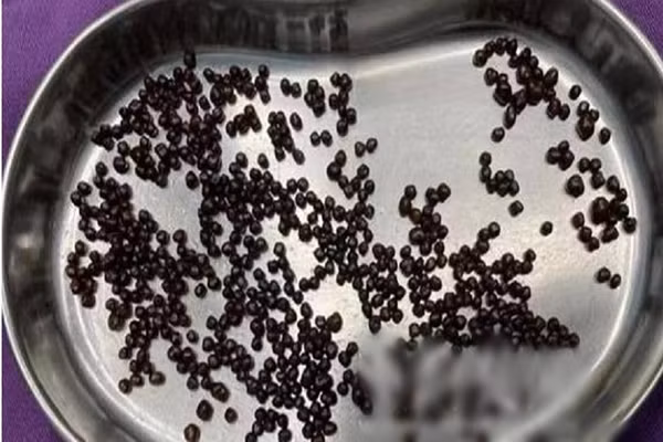 Dau bung nua nam, di kham phat hien dieu kinh di