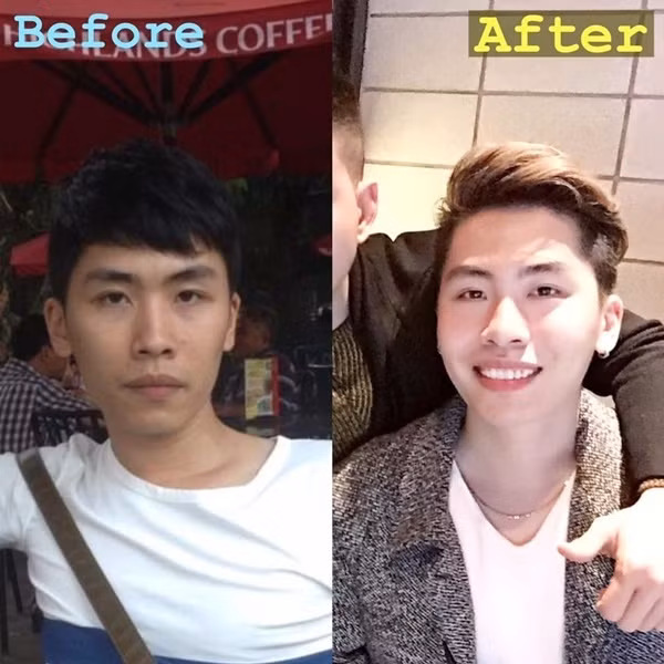 Vẻ ngoài điển trai này đã nhận được rất nhiều sự chú ý của cộng đồng mạng. Thế nhưng sau khi so sánh hình ảnh của bây giờ và quá khứ, không ít người đã sửng sốt về sự lột xác ngoạn mục này.