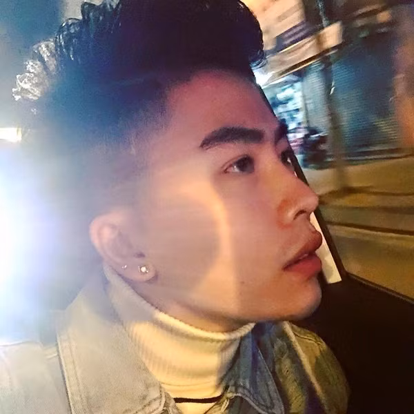 Tiêm mũi xong, cảm thấy khá an toàn và không thấy đau, Như Vũ quyết định làm đại trùng tu khuôn mặt. Trải qua 6 tháng thẩm mỹ và hồi phục, Như Vũ đã có diện mạo mới ưng ý. “Sau tiêm thẩm mỹ, mình tự tin hơn, cười nhiều hơn vì trước giờ có dám cười đâu. Ngoài ra, công việc cũng thuận lợi hơn nữa, khách hàng thích nói chuyện và kết bạn với mình.