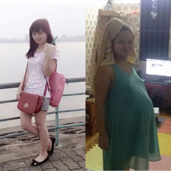 Ngoài việc nhìn cân nặng tăng vù vù thì nhan sắc của những người phụ nữ khi mang bầu cũng không thể còn được như thời con gái.