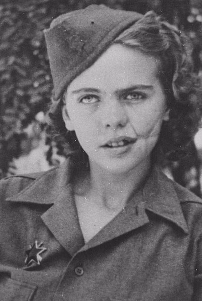Albina Mali-Hočevar - cô gái đến từ Yugoslavia bị thương nhiều lần trong Chiến tranh thế giới 2.