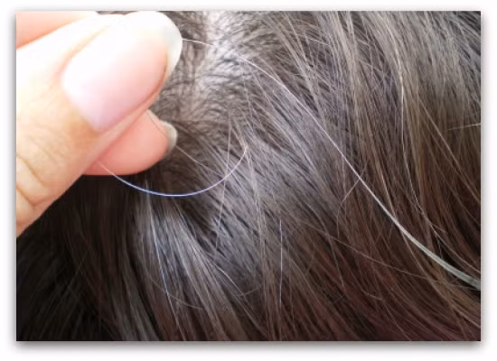 Khi bị bạc tóc kết hợp với xuất hiện các triệu chứng như đi tiểu nhiều, tiểu gắt, tiểu són, bí tiểu hoặc đi tiểu bất bình thường thì nên khám và chữa trị sớm để cải thiện tình hình.