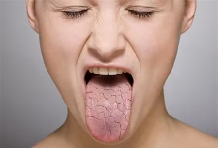 Ngoài ra, gừng có tính cay, nóng, ăn quá nhiều loại mứt này sẽ gây mất nước khô khan trong cơ thể khiến bạn bị nóng trong khó chịu.