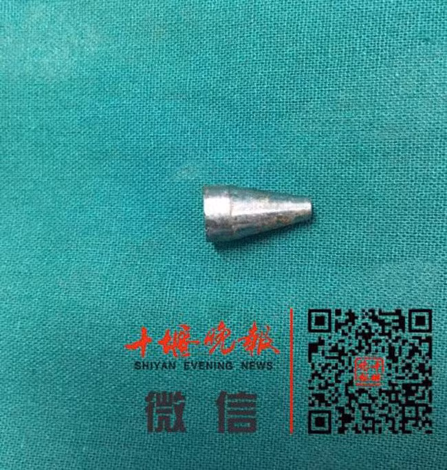 Bé gái 8 tuổi suýt mất mạng, bác sĩ phát hiện thứ khủng khiếp - Hình 2 Be gai 8 tuoi suyt mat mang, bac si phat hien thu khung khiep-Hinh-2