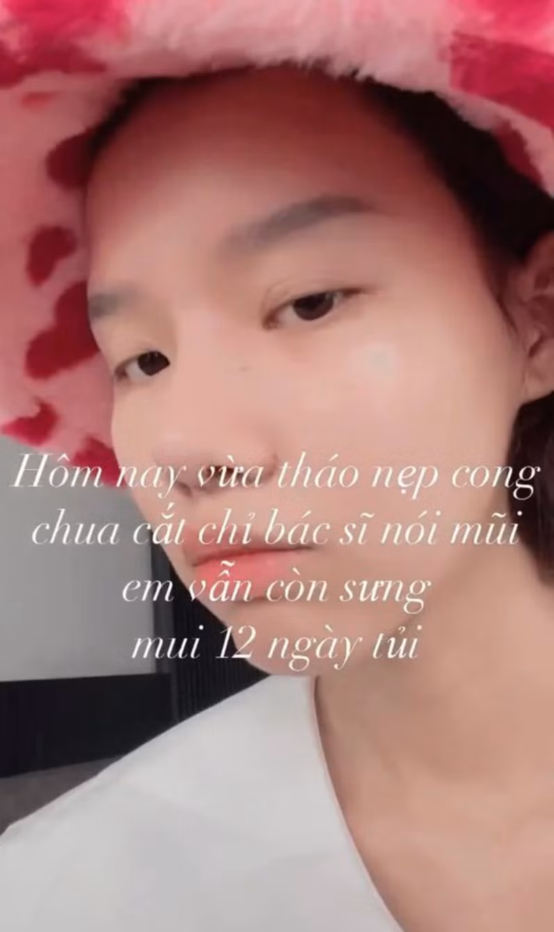 Sinh năm 2001, Jimin được nhiều người yêu thích bởi vẻ ngoài xinh xắn, rạng rỡ của mình qua các shoot ảnh trên trang cá nhân.