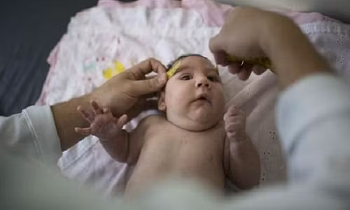 Hướng dẫn chẩn đoán và điều trị bệnh do virus Zika Huong dan chan doan va dieu tri benh do virus Zika