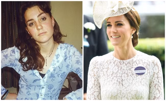 Kate Catherine, nữ Công Tước của Cambridge và là vợ của Hoàng tử William có vẻ ngoài "trẻ mãi không già" khi trông cô năm 18 tuổi và bây giờ ở tuổi 34 không khác nhau là mấy.