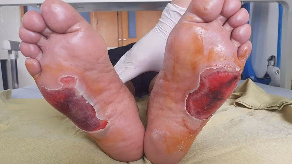 Bo tien mua 