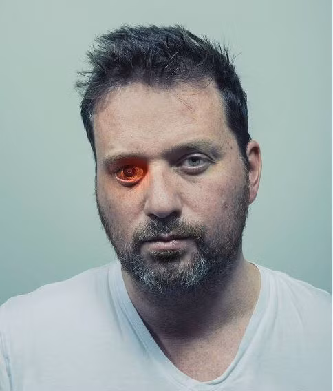 Rob Spence, hay còn được biết đến với cái tên The Eyeborg, bị mất một mắt từ nhỏ. Ông đã tạo ra một con mắt sinh học có gắn máy quay không dây bên trong.