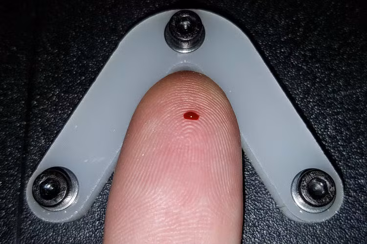 Một nhiệm vụ kỳ lạ nhưng đó là sự thật. Bạn chỉ cần để ngón tay vào vị trí xác định, sau đó khởi động con robot và nó sẽ sử dụng cánh tay bằng máy có gắn một cây kim để đâm vào ngón tay của bạn.