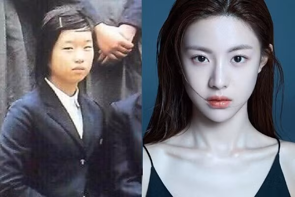 Go Youn Jung (sinh năm 1996) bất ngờ nổi tiếng sau loạt ảnh chụp cho một tạp chí thời trang tại Hàn Quốc vào năm ngoái. Cô nàng được dân mạng danh tặng biệt danh "nữ thần thế hệ mới" nhờ có "gương mặt đẹp không góc chết" và thần thái sang chảnh. Tuy nhiên, 9X từng lộ ảnh thời trung học, cho thấy nhan sắc khác xa hiện tại.