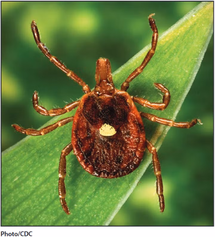 Loài bọ ngôi sao cô đơn, hay còn gọi là Lone Star tick (tên khoa học Amblyomma americanum), sống tại miền Đông nước Mỹ và Mexico, đã trở thành một hiện tượng đáng chú ý. Khi bị con bọ này cắn, con người sẽ phải đối mặt với một dị ứng đặc biệt: dị ứng thịt.