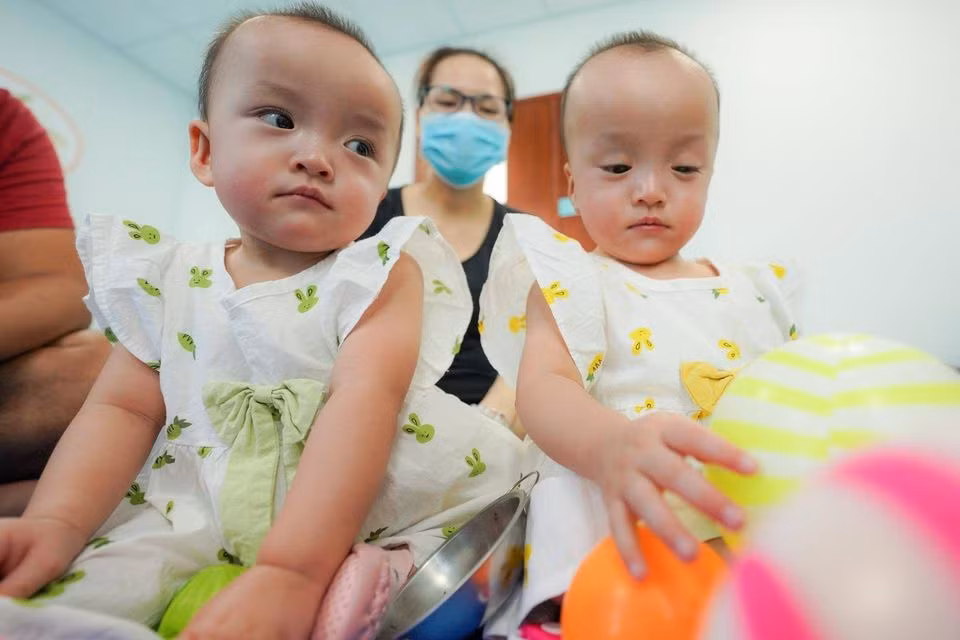 100 ngày sau ca đại phẫu tách rời, Hoàng Trúc Nhi và Hoàng Diệu Nhi (15 tháng tuổi) đã ổn định sức khỏe.