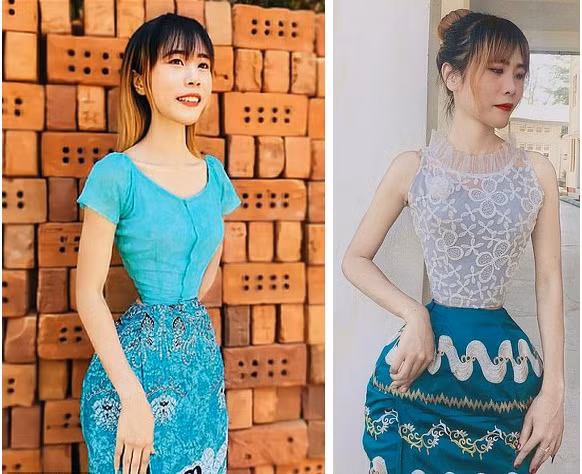 Theo các chuyên gia y tế, việc ép bản thân chịu đựng áp lực từ đai nịt bụng sẽ gây tác động xấu đến dạ dày, ảnh hưởng nghiêm trọng đến các cơ quan trong đường tiêu hoá.