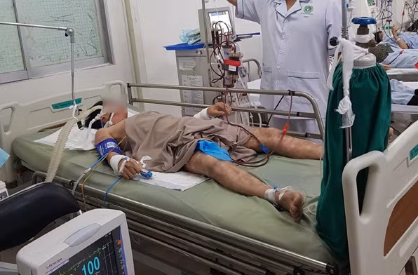 Hon me vi an bao tu ca mat tho: Ngo doc Tetrodotoxin cuc nguy hiem
