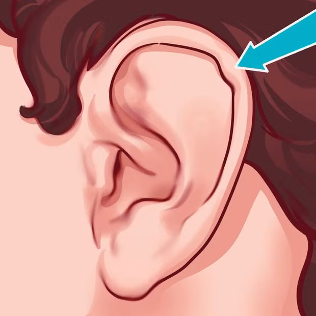 5. Đôi tai Darwin (Darwin’s tubercle) hay còn gọi là "sụn tai Darwin". Dấu hiệu nhận biết một người sở hữu đôi tai này, đó là có một phần sụn nhỏ lồi lên phía vành tai. Lý do có cái tên như vậy là vì Darwin chính là người đầu tiên đề cập đến nó. Đôi tai này khá vô dụng, chỉ là một phần còn sót lại của quá trình tiến hóa thôi.