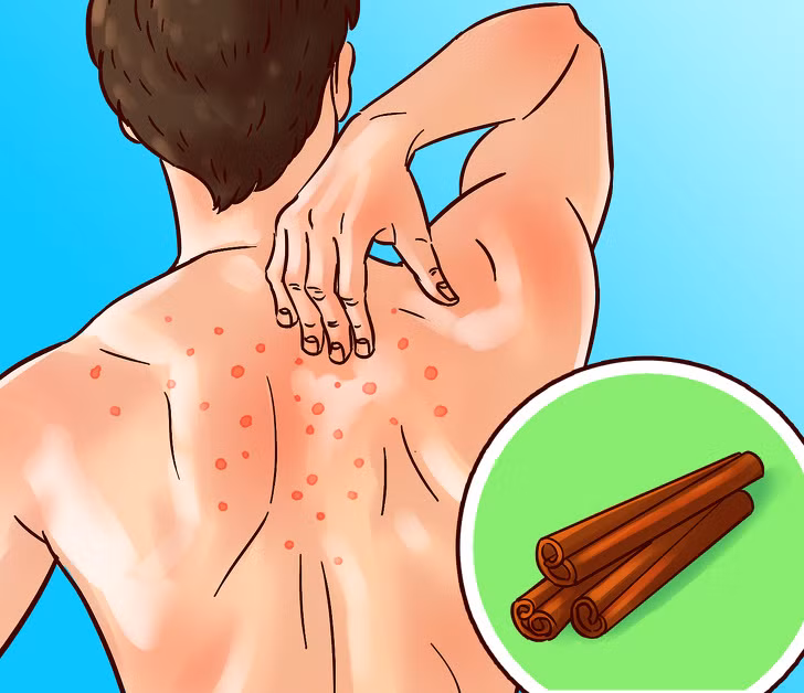 7. Quế: Quế có thể giúp chống nhiễm trùng cơ thể và sửa chữa tổn thương mô. Nó cũng chống viêm và có thể làm giảm nguy cơ mắc bệnh tim. Ngoài ra, quế cũng có thể giúp chống lại nhiễm trùng vi khuẩn và thậm chí bảo vệ bạn khỏi ung thư. Gia vị này có thể thêm vào trà, bánh, cà phê...