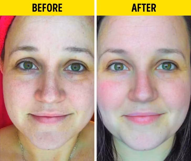 6 loi ich cua serum vitamin C voi lan da khien chi em 