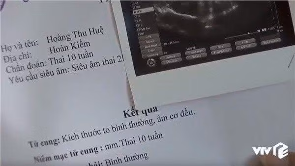 Phi cuoi voi 