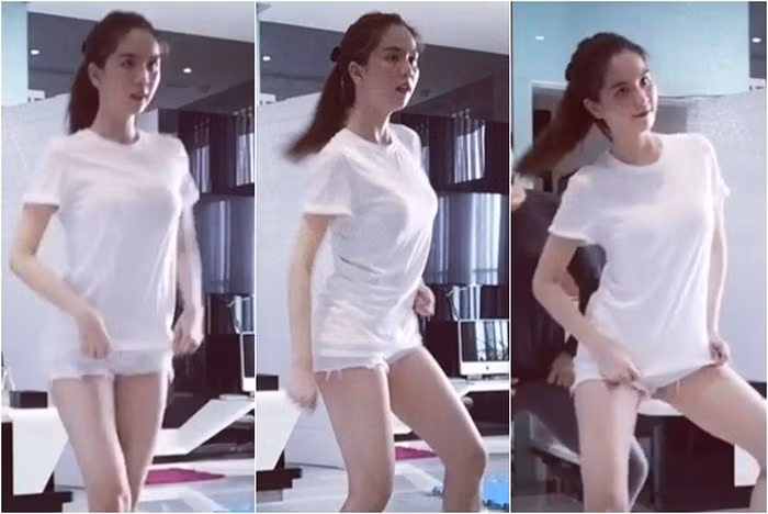 Việc tập nhảy khiến người đẹp gặp không ít trở ngại, nhất là cặp chân thon bị trầy xước, bầm tím.