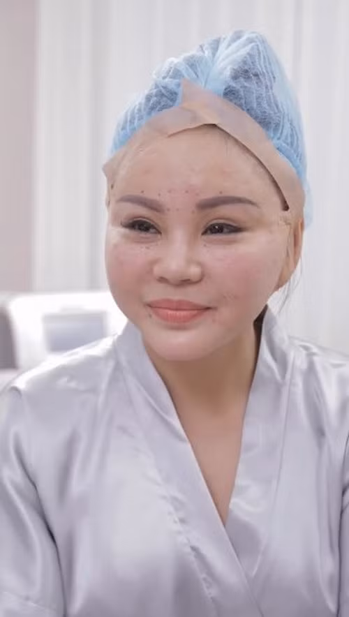 Câu chuyện Lê Giang dao kéo vốn không mới với khán giả. Vì số lần chỉnh sửa quá nhiều nên chính nữ nghệ sĩ hài cũng không nhớ đã phẫu thuật thẩm mỹ bao nhiêu lần.