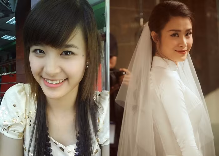 Hình ảnh Đông Nhi thuở mới vào nghề với hình ảnh của cô hậu kết hôn làm dấy lên nghi ngờ khi mũi của cô chưa được cao và thanh thoát như bây giờ.