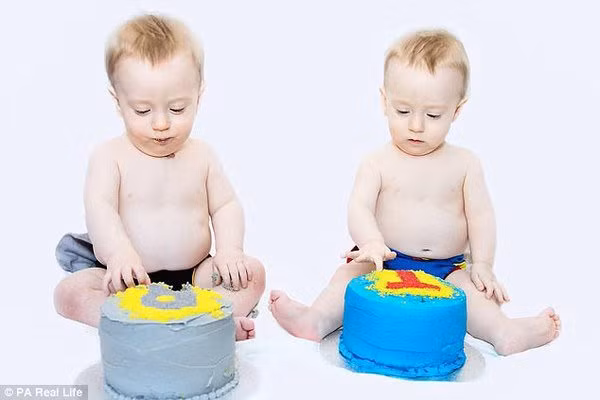 2 bé sinh đôi chung túi ối sống sót kỳ diệu nhờ ôm nhau trong suốt thai kỳ - Hình 3 2 be sinh doi chung tui oi song sot ky dieu nho om nhau trong suot thai ky-Hinh-3
