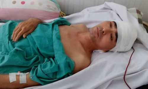Dien vien Nguyen Hoang nhap vien, mot chan nhu hoa da
