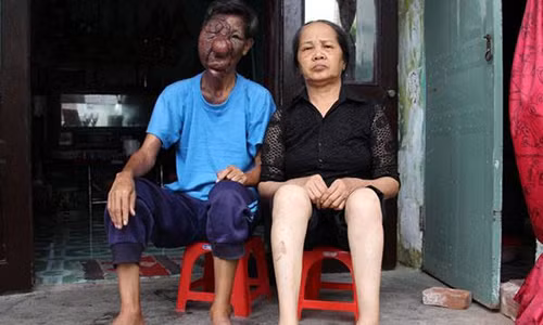 Chuyen tinh cam dong cua ong lao an xin co khuon mat bien dang